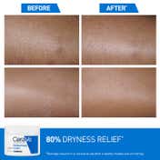 CeraVe Moisturizer Cream For Dry Skin & Barrier Repair (340 g)