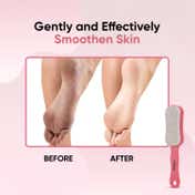 Vega Double Sided Pumice Stone with Handle for Dead Skin & Callus Remover (PD-24)