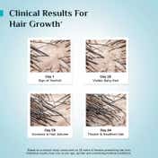 Pilgrim Redensyl and Anagain Advanced Hair Growth Serum (30 ml)