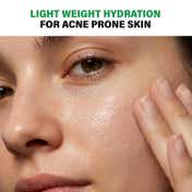 Novology Acne Light Moisturizing Gel for Oily Acne Prone Skin Upto 100 hours of Hydration (50 g)