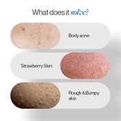 Be Bodywise 1% Salicylic Acid Body Wash For Body Acne (250ml)