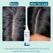 WishCare Hydrating AHA BHA Anti Dandruff Shampoo Reduces Itchiness 100% Dandruff Reduction (250 ml)