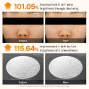 Dr.Melaxin Peel Shot Exfoliating Kojic Acid Turmeric Serum (80 ml)