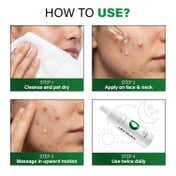Novology Acne Clearing Serum for Pimples Whiteheads Blackheads For Sensitive Skin (28 ml)
