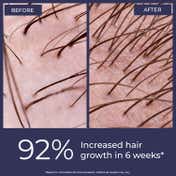 Conscious Chemist Full Strength Hair Growth Oil (100 ml)