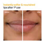 WishCare Natural Ceramide Lip Balm for Dark Pigmented Lips with SPF50 PA+++ Heals Chapped Lips (5 g)