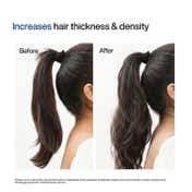 Wishcare Hair Growth Serum Concentrate Roll On - In-Vivo Tested (10 ml)