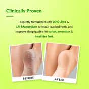 Fixderma Foobetik Foot Roll On for Dry & Cracked Heels (60 ml)