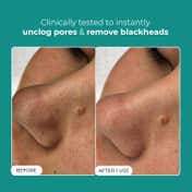 Conscious Chemist Blackhead Melting Water (50 ml)