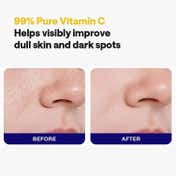 MEDIHEAL Vitamin C Essential Mask Clear Toning (24 ml)