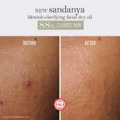 Kama Ayurveda Sandanya Blemish Clarifying Dry Oil (15 ml)