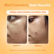 The Pink Foundry Brightening & Exfoliating Vit-C Daily Face Wash (100 ml)
