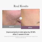 medicube Age-R Glutathione Glow Capsule Cream (50 ml)