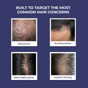 Conscious Chemist Full Strength Hair Growth Oil (100 ml)