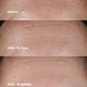 CLINIQUE Age Defense Routine Skincare Set (4 pcs)