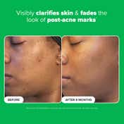 PAULA'S CHOICE Boost 10% Azelaic Acid Booster (30 ml)