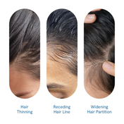 Be Bodywise Hair Growth Serum Roll On (50 ml)