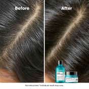 L'OREAL PROFESSIONNEL Scalp Advanced Anti-Oiliness Dermo-Purifier Shampoo (300 ml) for Oily Scalps