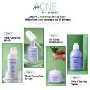 Sereko Anti Acne Moisturiser with Zinc PCA and Lactic Acid for Oil Control and Redness (50 ml)
