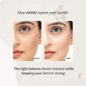 Akind Sleep Tight Firming Serum (30 ml), Anti-Ageing & Fine Lines with 0.015% Retinol & AHA