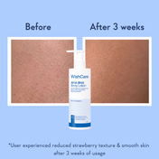 WishCare AHA + BHA Exfoliating Body Lotion Provides Deep Hydration and Detan Skin (200 ml)