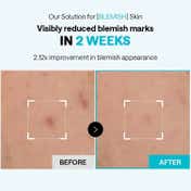 MEDIHEAL Madecassoside Blemish Pad (170 ml)