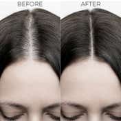 Brillare Hair Fall Control Shampoo To Reduce Seasonal Hair Fall (300 ml)