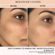 BiE Fresh Forward Deep Hydrating Cleanser - pH-Balanced Makeup Remover (100 ml)