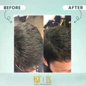 KT MEN Dark Revive Anti Grey Conditioning Shampoo Restore Natural Black - RCB (200 ml)