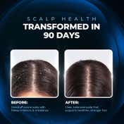 Streax Professional Anti Dandruff Hair Mask (200 g)