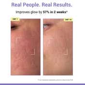 Sereko Vitamin C Toner with Niacinamide and Glycolic Acid (100 ml)