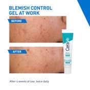 CeraVe Blemish Control Gel with 2% Salicylic Acid (40 ml)