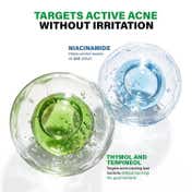 Novology Acne Spot Corrector for Active Acne Pimples and Whiteheads (30 g)