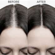 Brillare 40% Onion Oil Shots for Hair Fall Reduction (48 ml)