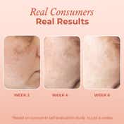 The Pink Foundry Dark Spot & Hyperpigmentation Correcting Power Serum (30ml)