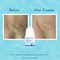 WishCare Aqua Fresh Underarm Roll On Serum Reduces Pigmentation and Prevents Body Odour (50 ml)