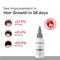 Protouch Complete Hair Growth Combo