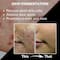 House of Beauty High Frequency Magic Wand - (5Pcs)