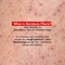 Conscious Chemist Body Exfoliating & Pigmentation Corrector Cream for Hard Bumps & Strawberry Skin