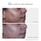 Novology Acne Clearing Face Wash Face Wash for Acne Whiteheads Blackheads Non-Drying (150 g)