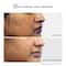 Novology Pigmentation Moisturiser Face Cream for Hyperpigmentation & Dark Spots (50 g)