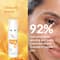 Fixderma 17% Vitamin C Face Serum for Glowing Skin Anti Aging Night Face Serum (30g)