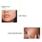 Fixderma 2% Salicylic Acid Serum for Anti Acne Treatment with 5% Azelaic Acid & 4% Mandelic (30 g)