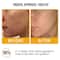 Insight Cosmetics Vit C & Glutathione Radiant Glow Face Serum (30 ml)
