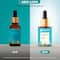 Pilgrim 10% Niacinamide Face Serum For Acne Marks (30 ml)