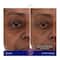 Augustinus Bader The Eye Patches (Pack of 6)