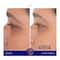 Augustinus Bader The Eye Patches (Pack of 6)