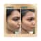 Ras Luxury Skincare Spot Corrector & Acne Marks Correcting Advanced Booster Serum (10 ml)