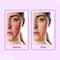 The Derma Co Hypochlorous Anti-Acne Hydrating Spray (200 ml)