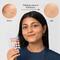 Gush Beauty Dart It Hydrocolloid Pimple Patches for Healing Acne, Zits and Blemishes - Flower